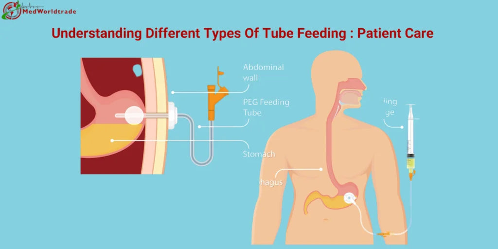 Understanding-Different-Types-Of-Tube-Feeding-In-2023-Patient-Care