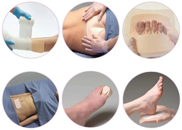 Aquacel Foam Dressing
