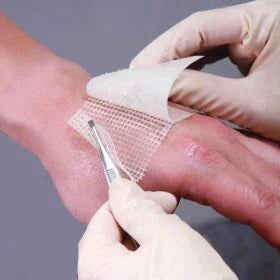 Jelonet Paraffin Gauze Dressing