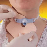 Allevyn Tracheostomy Dressing